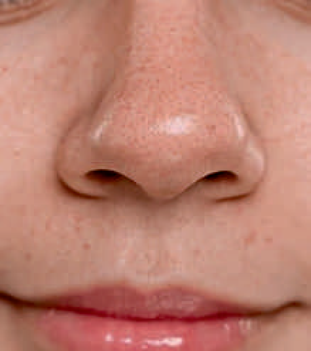 b2